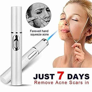 Blue Light Therapy Acne device Pen Soft Scar Wrinkle Removal Treatment laser Skin Care Beauty Equipment