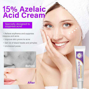 Revitalize Your Skin with Our Azelaic Acid Skin Brightener - Enhanced with Niacinamide & Vitamin C